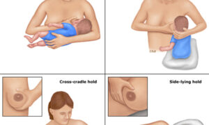 Cách xử lý khi mẹ bị tắc sữa !
